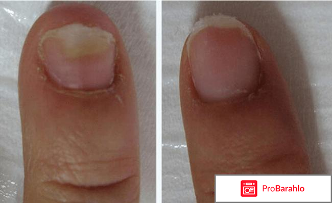 Отзывы номидол отрицательные отзывы