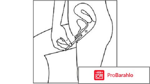 Клотримазол свечи отзывы при молочнице у женщин отрицательные отзывы