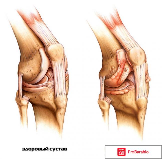 Сусталайф (Sustalife) реальные отзывы