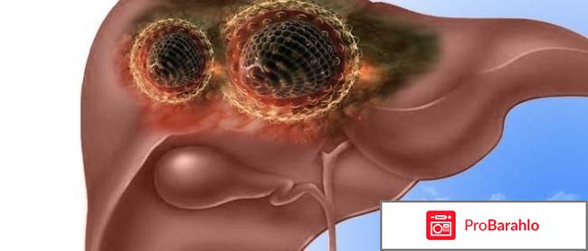 Гринтерол инструкция по применению цена аналоги отрицательные отзывы