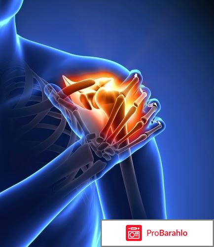 Пантофлекс (Pantofleks) реальные отзывы