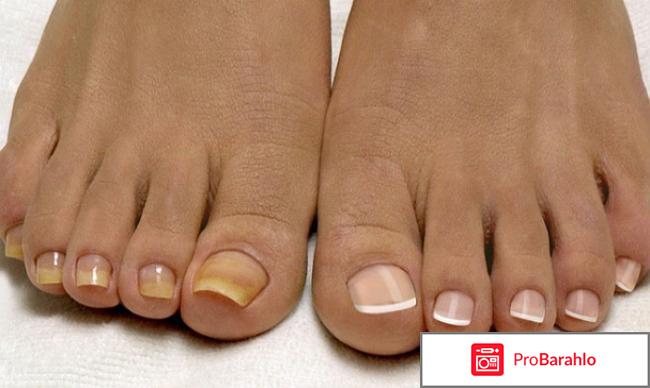 Tinedol (Тинедол) фото