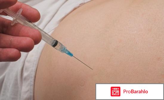 Акупан обман