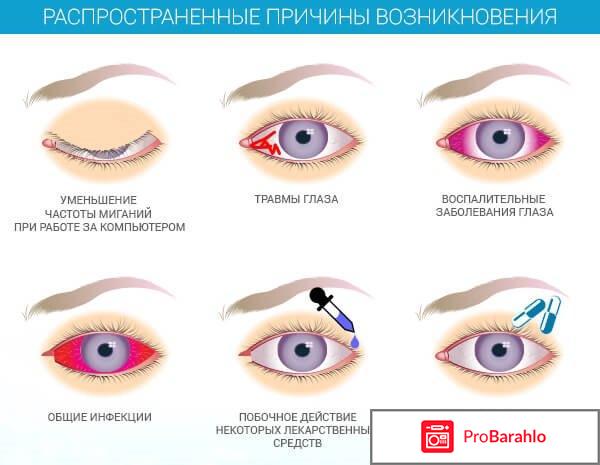 Тобрадекс глазные капли инструкция цена аналоги отзывы обман