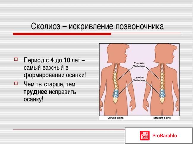 Операция на удаление сколиоза позвоночника отрицательные отзывы