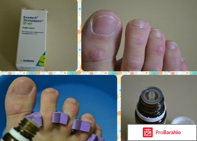 Отзывы экзодерил отзывы владельцев