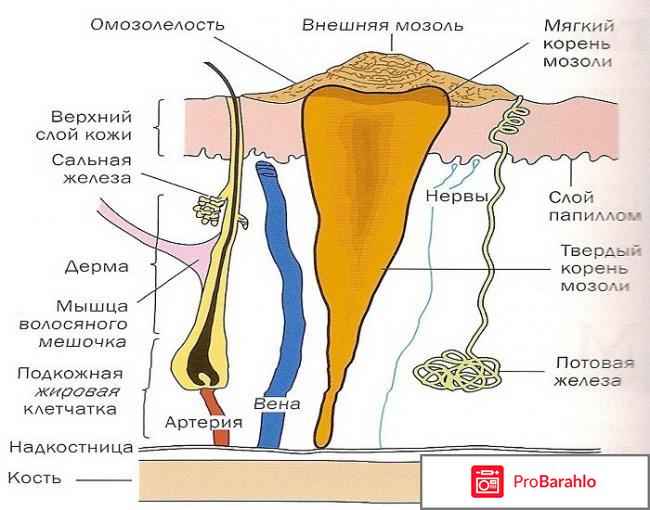 Обильные выделения из влагалища 