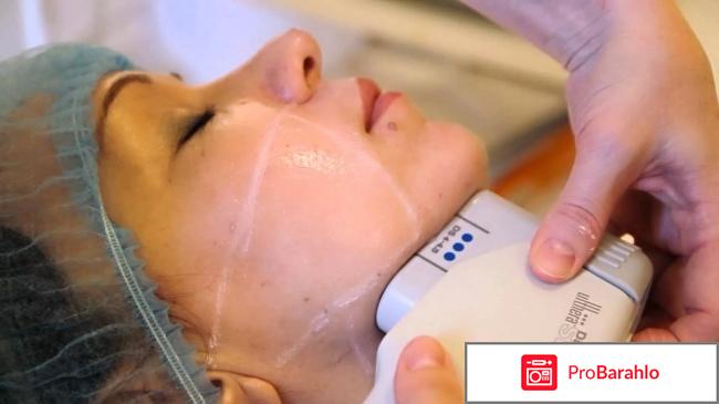 Альтера систем отзывы отрицательные обман