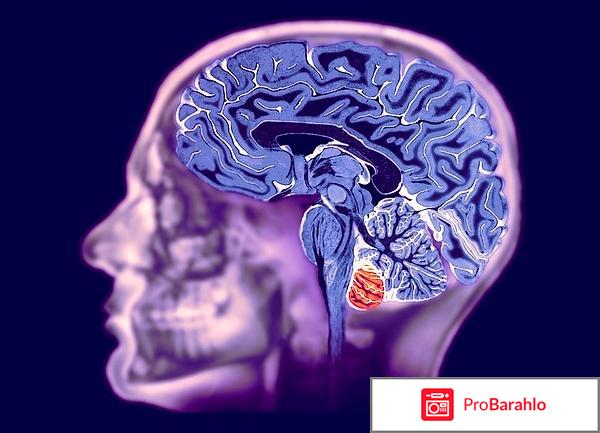 Мрт головного мозга отрицательные отзывы