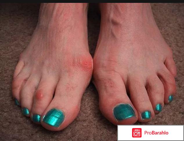 Шишка стоп отзывы отрицательные 