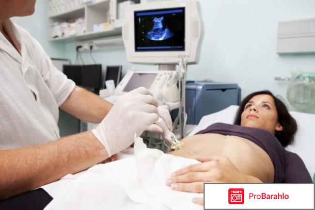 Узи в волгограде обман