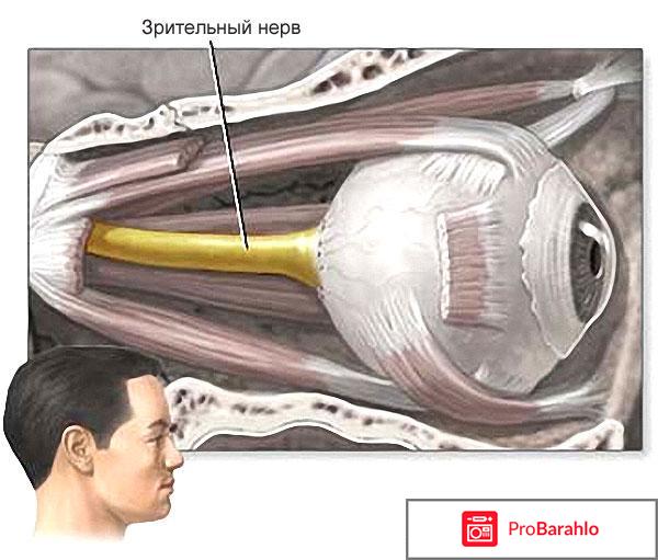 Атрофия глазного нерва лечение и прогноз 