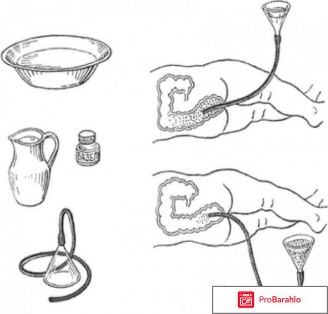 Клизмы для похудения в домашних условиях отзывы обман