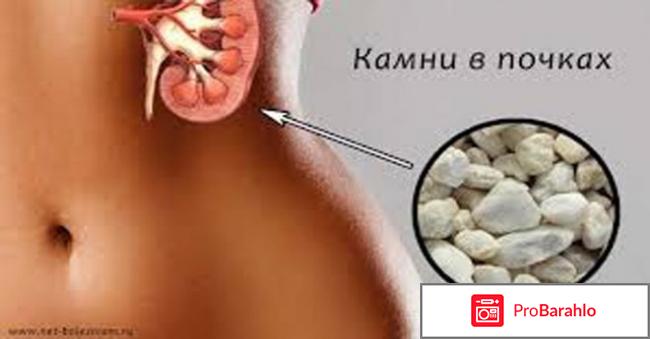 РОВАТИНЕКС аналоги отрицательные отзывы