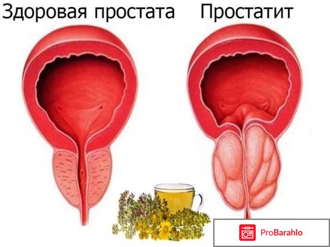 Простанорм инструкция по применению цена таблетки реальные отзывы