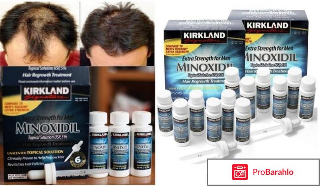 Миноксидин обман