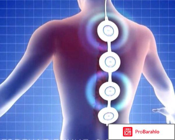 Алмаг при остеохондрозе обман