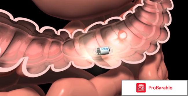 Как проверить кишечник кроме колоноскопии отрицательные отзывы