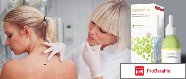 Отрицательные папилайт обман