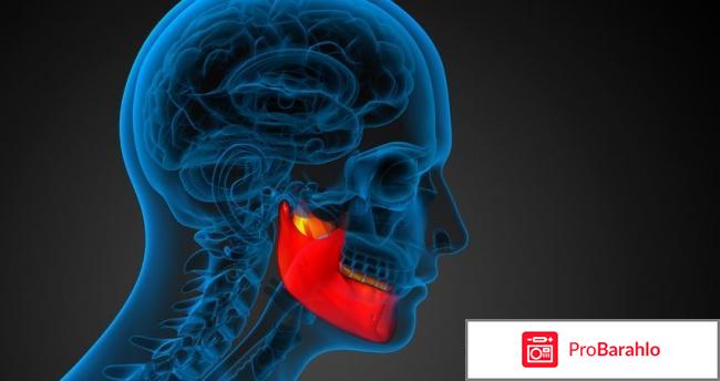 Мрт нижней челюсти 