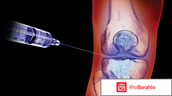 Гиалурон уколы для суставов отзывы цена отрицательные отзывы