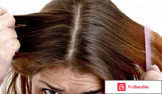 Низорал шампунь инструкция по применению цена отзывы 