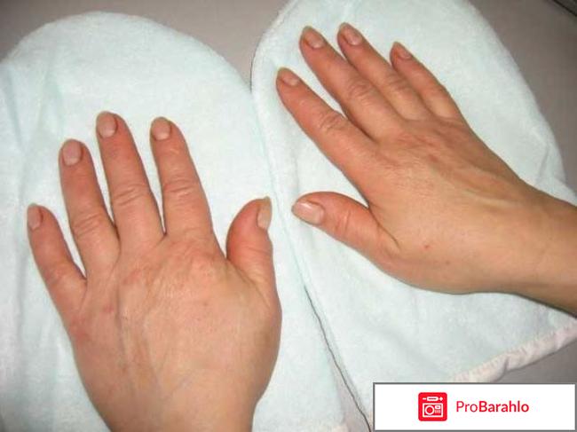 Лостерин мазь цена отзывы и эффективность 