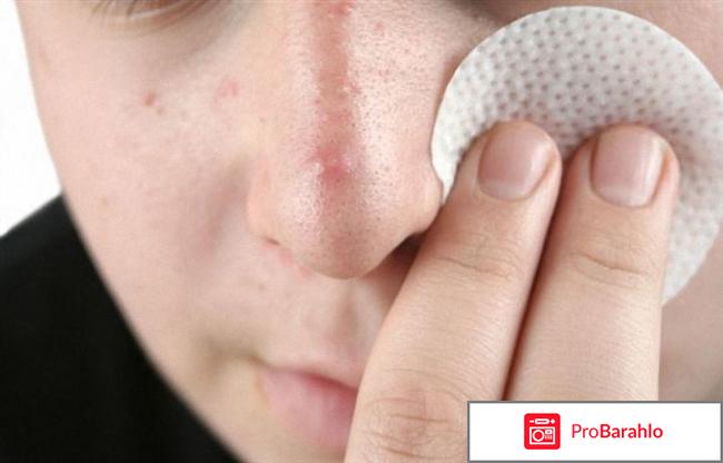 Как избавиться от комедонов на лице в домашних условиях отрицательные отзывы