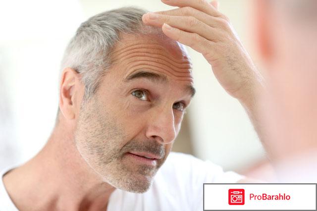 Шампунь укрепляющий против выпадения волос отзывы 