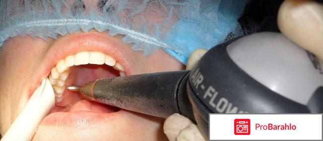 Отбеливание аир флоу 