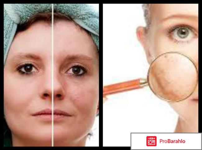 Как избавиться от пигментации лица быстрее всего отрицательные отзывы