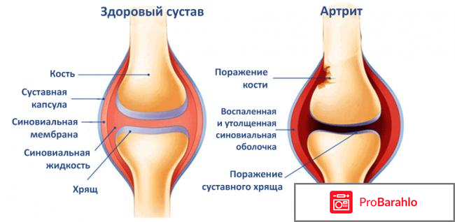 Сустафаст для суставов цена 