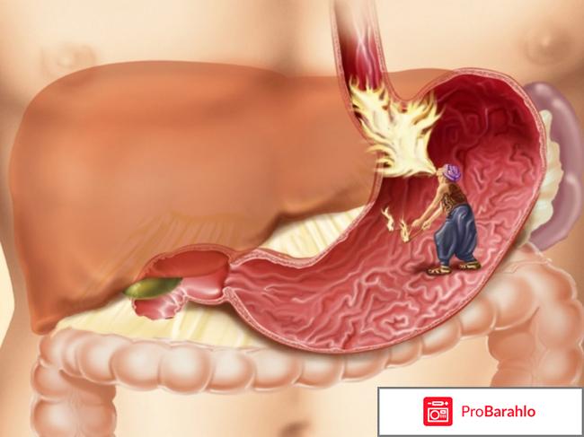 Разо инструкция по применению отзывы обман