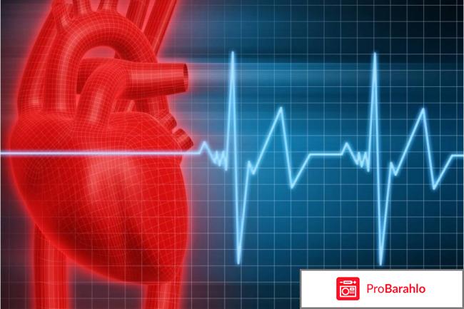 Аспаркам отзывы кардиологов 