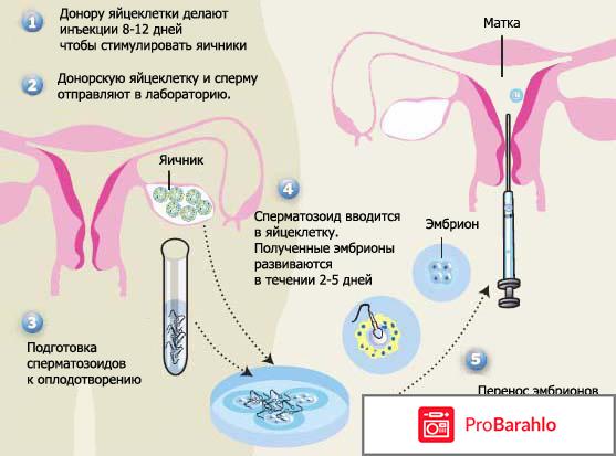 Последствия после эко для организма женщины отзывы обман