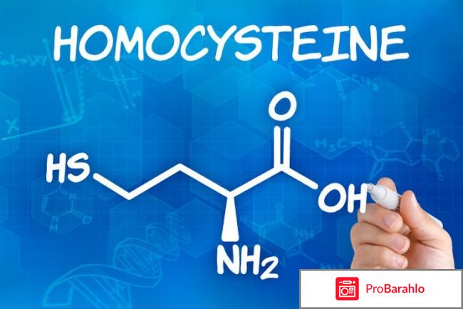 Гомоцистеин норма 