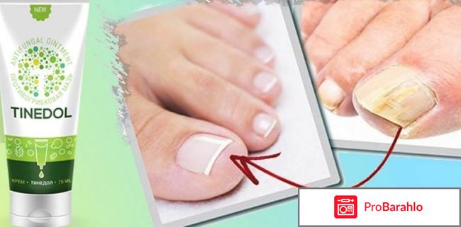 Новастеп - Novastep от грибка обман