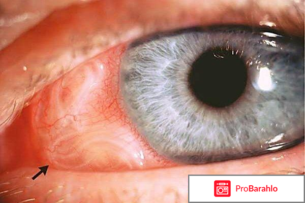 Противопаразитарное средство 