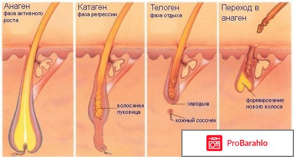 Elos эпиляция отрицательные отзывы