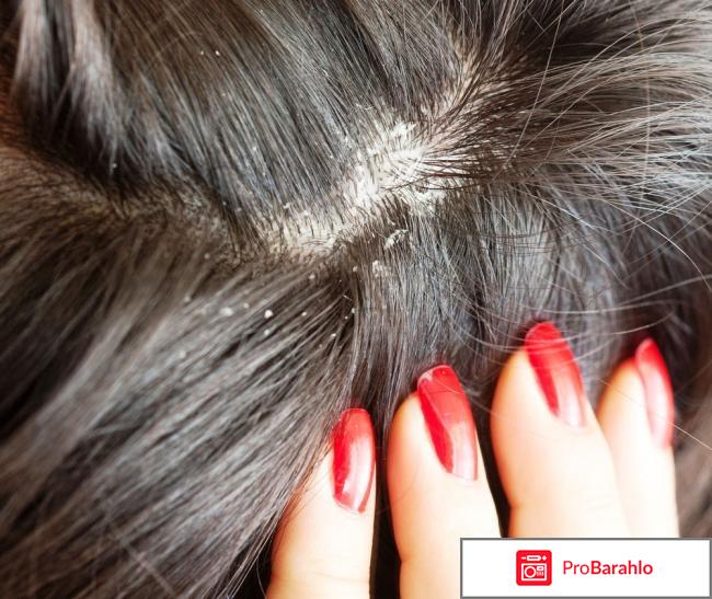 Лечение перхоти Kelual DS Shampooing Traitant Etats Squameux Ducray 