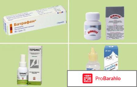 Средства против грибка ногтей 