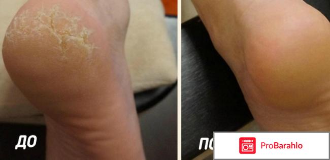 Wellneo Шелковистые пяточки 3 в 1 реальные отзывы