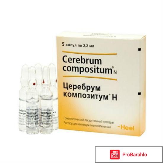 Церебрум композитум н обман