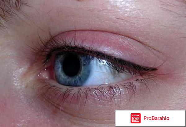 Межресничный татуаж 