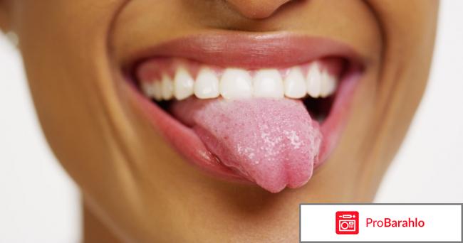 Серый налет на языке, причины обман