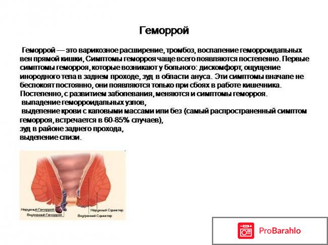 Чем лечить геморрой у женщин отзывы обман