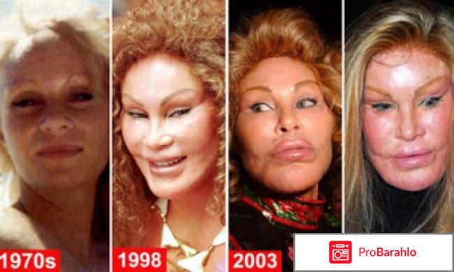 Пластика: за и против. Отзывы отрицательные отзывы