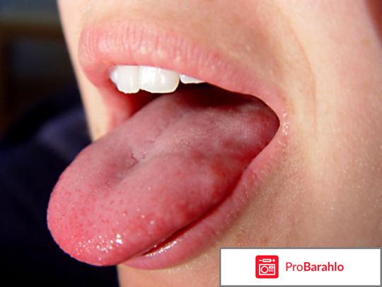 Неровный язык по краям 