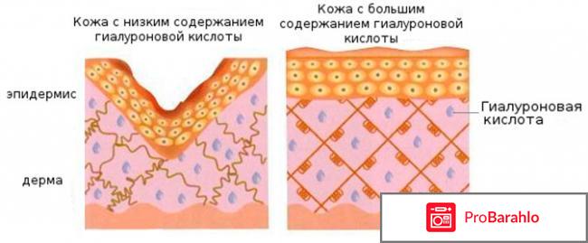 Гиалурон (Гиалуроника) обман