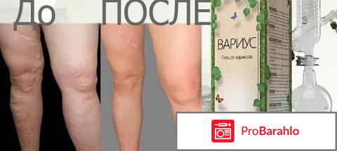 Вариус отзывы обман